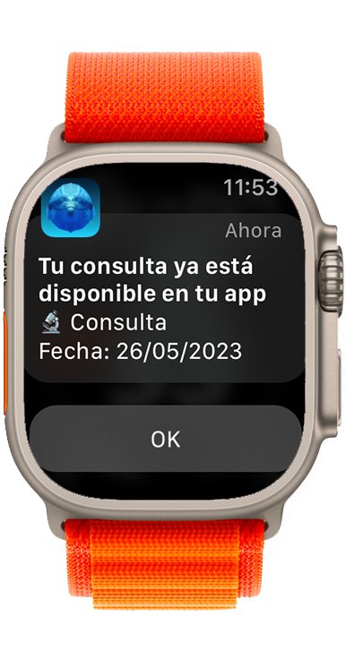 Apple Watch Consulta